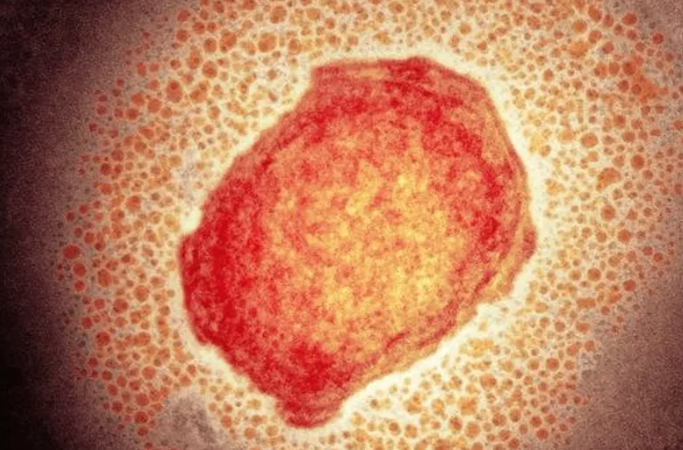 Arapiraca registra primeiros casos suspeitos de varíola dos macacos