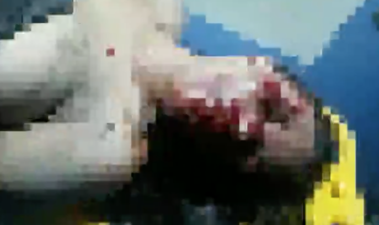 Família denuncia que jovem teve o rosto desfigurado por agressões do namorado em Capela, AL