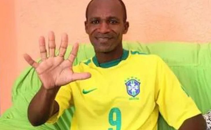Baiano com seis dedos pretende comemorar hexa da seleção com uma mão só: ‘Fico ansioso’