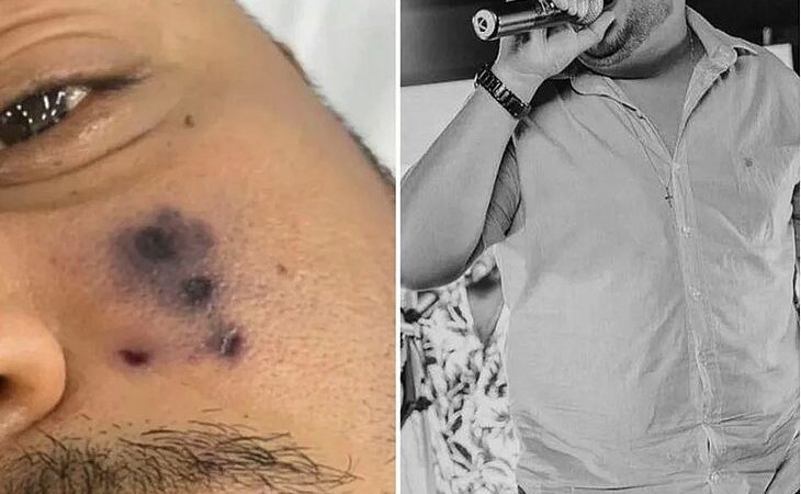 Forrozeiro morre após picada de aranha