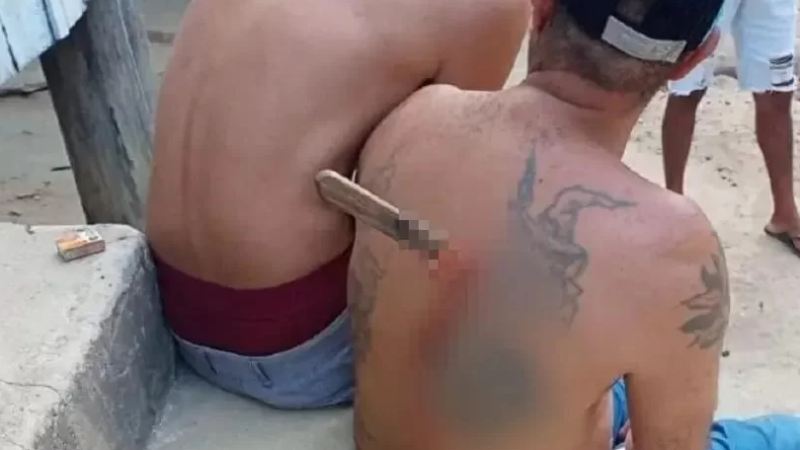 Homem esfaqueado após discussão fica com faca cravada nas costas