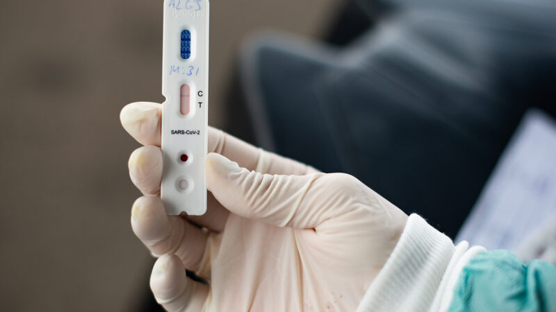 Seis UPAs do Estado oferecem teste rápido para Covid-19