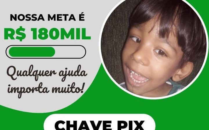 Familia realiza campanha solidária para recada 180 mil para o tratamento de criança com hidrocefalia