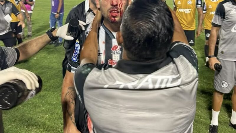 Polícia identifica torcedor do CSE que arremessou lata em jogador do ASA