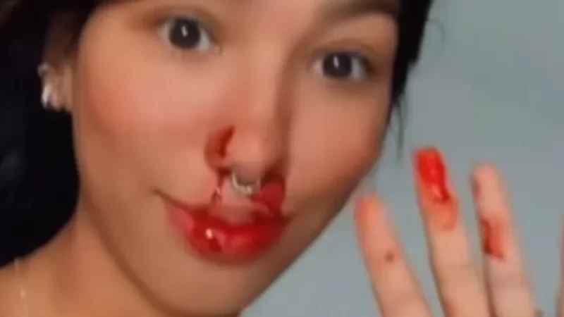 Jovem agredida por morador de rua: “Meteu o murro no meu nariz”