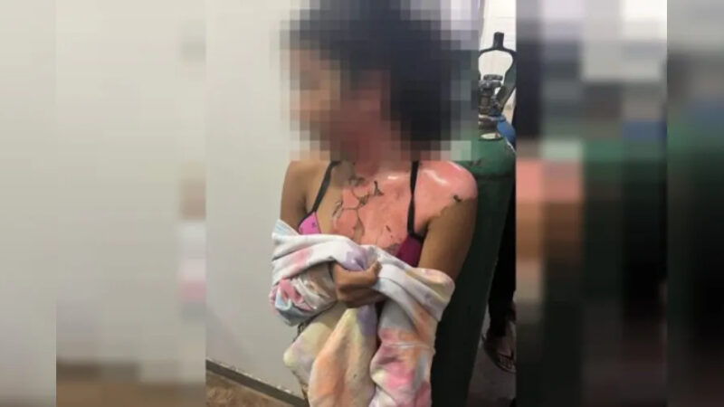 Tia agride sobrinha com água fervente ao suspeitar de relacionamento com marido