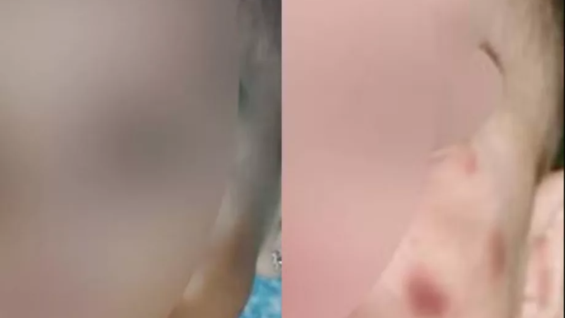 Mãe é presa por maus-tratos após maquiar rosto de bebê para esconder hematomas