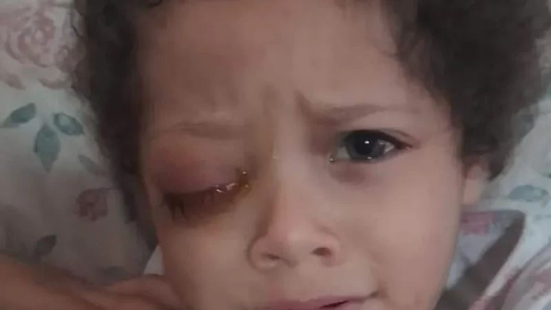 Aflito, pai de criança de 4 anos pede ajuda para tratamento de câncer