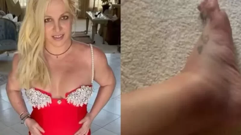 Britney Spears mostra tornozelo torcido e fala de relação com a mãe