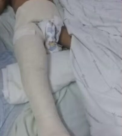 Padrasto se entrega e confessa que espancou criança em AL e tentou colocar osso quebrado lugar