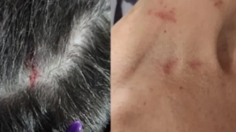 Mulher diz ter sido agredida com cassetete por esposa de policial