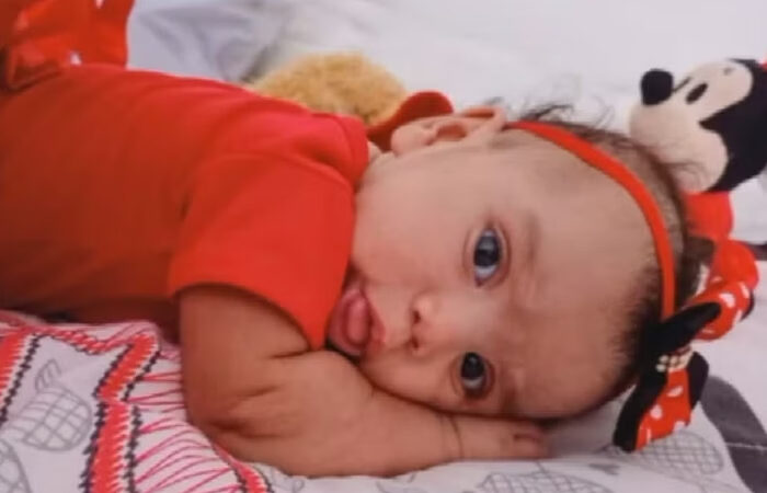 Após ser deixada sozinha pelos pais, bebê é atacada por cão e morre