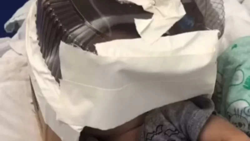 Morre bebê que usou embalagem de bolo como máscara de oxigênio