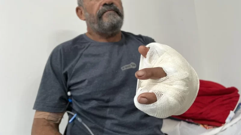 HGE evita amputação da mão esquerda de técnico em eletrônica