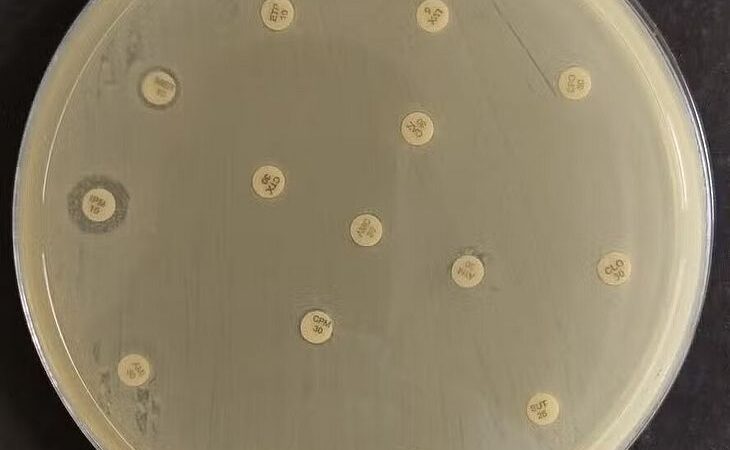 Bactéria resistente que representa risco global é detectada no Nordeste