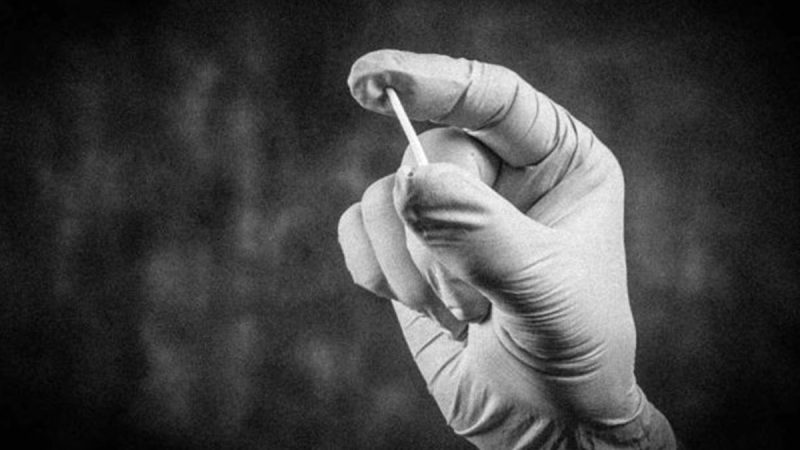 Chip da beleza: o que você precisa saber sobre o implante hormonal