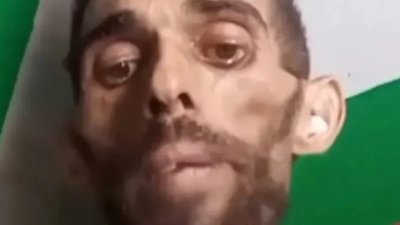 Morre em hospital o alagoano que implorou por tratamento contra câncer