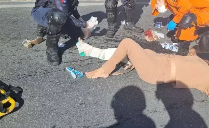 Mulher tem perna dilacerada por caminhão próximo ao acesso de shopping em Maceió