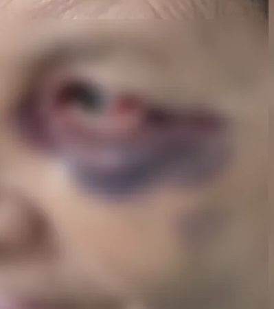 Homem é preso após espancar mãe idosa de 72 anos em Palmeira dos Índios