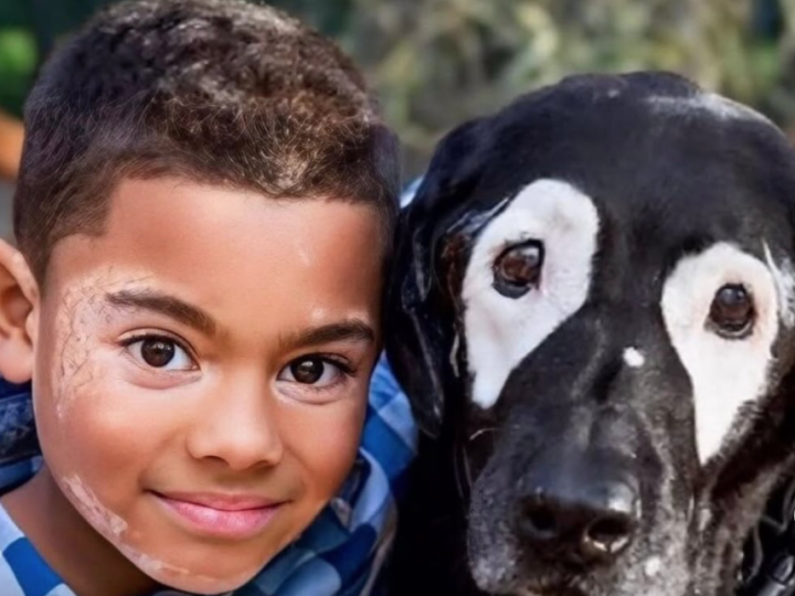 Uma amizade que cura: menino com vitiligo encontra inspiração em cão com a mesma condição