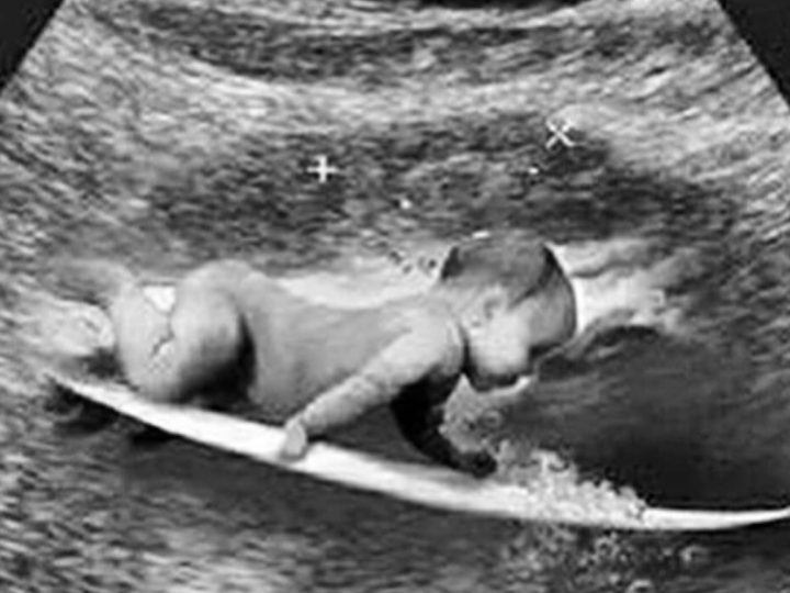 Gabriel Medina levanta rumores de paternidade após postar “ultrassom” curioso nas redes sociais