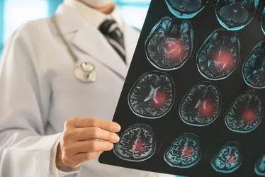 Senado aprova “OAB da Medicina” e recém-formados terão de passar por exame obrigatório