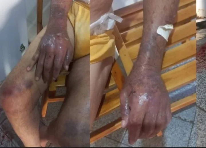 Caso grave em Belo Monte: filha é detida por maus-tratos e falta de socorro a idoso