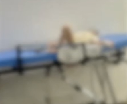 Criança de 2 anos sofre fratura no fêmur após acidente doméstico e família denuncia falha em atendimento na UPA de Palmeira dos Índios