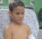 Menino de 10 anos tem parte do braço amputado após colisão entre ambulância e ônibus na BR-316, em Maribondo