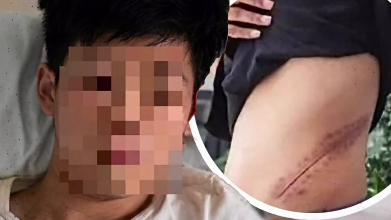 Uma decisão tomada no impulso pode deixar marcas para a vida inteira